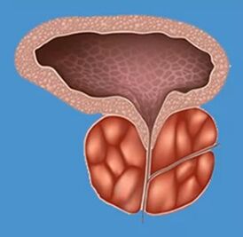 Characteristic signs of prostate